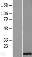 C11orf75 (SMCO4) Human Over-expression Lysates NM_020179
