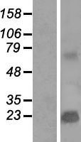 TMEPAI (PMEPA1) Human Over-expression Lysates NM_199170