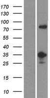 MFF Human Over-expression Lysates NM_020194