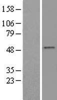 SMYD2 Human Over-expression Lysates NM_020197