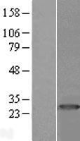 PRTFDC1 Human Over-expression Lysates NM_020200