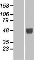 LHX9 Human Over-expression Lysates NM_020204
