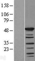SHD Human Over-expression Lysates NM_020209