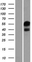 ATXN7L3 Human Over-expression Lysates NM_020218