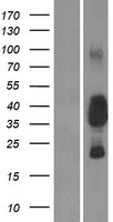CEACAM19 Human Over-expression Lysates NM_020219