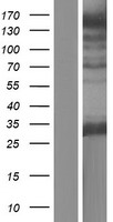 STOX2 Human Over-expression Lysates NM_020225
