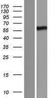 PRDM11 Human Over-expression Lysates NM_020229