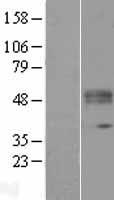 KTEL1 (POGLUT1) Human Over-expression Lysates NM_152305