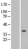 DTWD1 Human Over-expression Lysates NM_020234