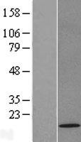 TOMM22 Human Over-expression Lysates NM_020243