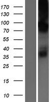 CHPT1 Human Over-expression Lysates NM_020244