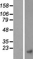 CTNNBIP1 Human Over-expression Lysates NM_001012329