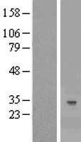 C7orf36 (YAE1D1) Human Over-expression Lysates NM_020192