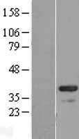 CABP4 Human Over-expression Lysates NM_145200