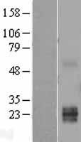 TWSG1 Human Over-expression Lysates NM_020648