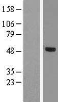 TBX20 Human Over-expression Lysates NM_001077653