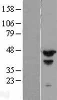 MCG10 (PCBP4) Human Over-expression Lysates NM_033008