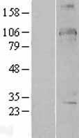 DDX24 Human Over-expression Lysates NM_020414