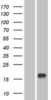 AGTRAP Human Over-expression Lysates NM_020350