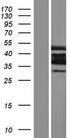 PLSCR4 Human Over-expression Lysates NM_001177304