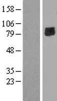 ENTPD7 Human Over-expression Lysates NM_020354