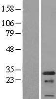 PCNP Human Over-expression Lysates NM_020357