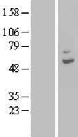 CPA6 Human Over-expression Lysates NM_020361