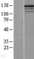 RPGRIP1 Human Over-expression Lysates NM_020366