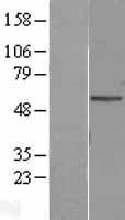 Adipose Triglyceride Lipase (PNPLA2) Human Over-expression Lysates NM_020376