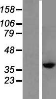 CysLT2 (CYSLTR2) Human Over-expression Lysates NM_020377