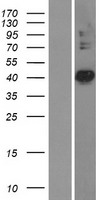 PDSS2 Human Over-expression Lysates NM_020381