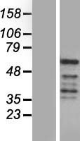 REXO4 Human Over-expression Lysates NM_020385