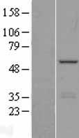ls057117 phf22 ints12 human over expression lysates nm 001142471 wb testing 2