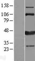CAMK1D Human Over-expression Lysates NM_153498