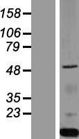 PIST (GOPC) Human Over-expression Lysates NM_020399