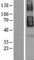TEM7 (PLXDC1) Human Over-expression Lysates NM_020405