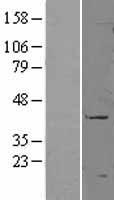 CD177 Human Over-expression Lysates NM_020406