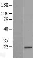 MRPL47 Human Over-expression Lysates NM_177988
