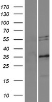 Nogo A (RTN4) Human Over-expression Lysates NM_020532