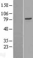 PAK5 Human Over-expression Lysates NM_020341
