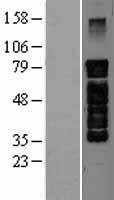 PAK5 Human Over-expression Lysates NM_177990