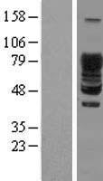 SCY1 like 3 (SCYL3) Human Over-expression Lysates NM_020423