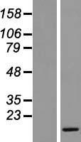 SMIM8 Human Over-expression Lysates NM_020425