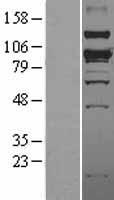 ls057154 smurf1 human over expression lysates nm 181349 wb testing 2