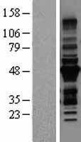 MURF3 (TRIM54) Human Over-expression Lysates NM_032546