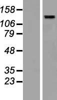 SALL4 Human Over-expression Lysates NM_020436