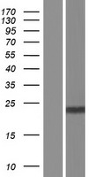 ls057171 dolpp1 human over expression lysates nm 001135917 wb testing 2