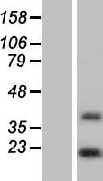ls057171 dolpp1 human over expression lysates nm 020438 wb testing 1