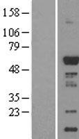 CaMKI gamma (CAMK1G) Human Over-expression Lysates NM_020439