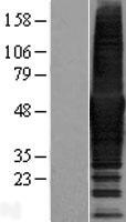 CORO1B Human Over-expression Lysates NM_001018070